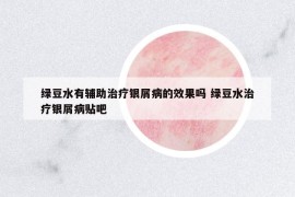 綠豆水有輔助治療銀屑病的效果嗎 綠豆水治療銀屑病貼吧