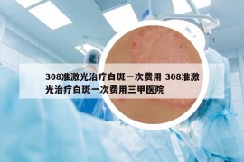308準(zhǔn)激光治療白斑一次費(fèi)用 308準(zhǔn)激光治療白斑一次費(fèi)用三甲醫(yī)院