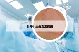 冬天牛皮癬高發(fā)原因
