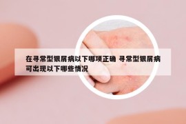 在尋常型銀屑病以下哪項(xiàng)正確 尋常型銀屑病可出現(xiàn)以下哪些情況