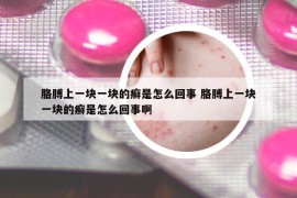 胳膊上一塊一塊的癬是怎么回事 胳膊上一塊一塊的癬是怎么回事啊