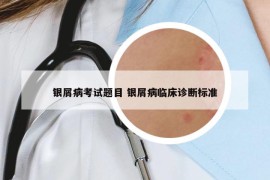 銀屑病考試題目 銀屑病臨床診斷標(biāo)準(zhǔn)