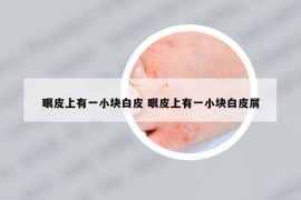 眼皮上有一小塊白皮 眼皮上有一小塊白皮屑