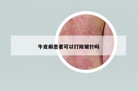 牛皮癬患者可以打除皺針嗎