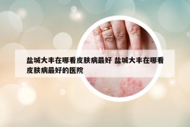 鹽城大豐在哪看皮膚病最好 鹽城大豐在哪看皮膚病最好的醫(yī)院