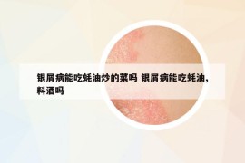 銀屑病能吃蠔油炒的菜嗎 銀屑病能吃蠔油,料酒嗎