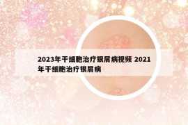 2023年干細(xì)胞治療銀屑病視頻 2021年干細(xì)胞治療銀屑病