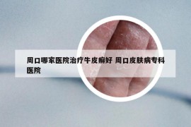 周口哪家醫(yī)院治療牛皮癬好 周口皮膚病?？漆t(yī)院