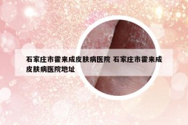 石家莊市霍來成皮膚病醫(yī)院 石家莊市霍來成皮膚病醫(yī)院地址