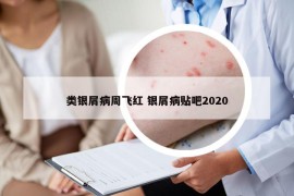 類銀屑病周飛紅 銀屑病貼吧2020