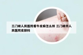 三門峽人民醫(yī)院看牛皮癬怎么樣 三門峽市人民醫(yī)院皮膚科