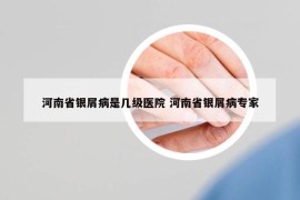 河南省銀屑病是幾級醫(yī)院 河南省銀屑病專家