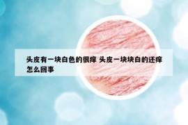 頭皮有一塊白色的很癢 頭皮一塊塊白的還癢怎么回事