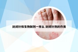 封閉針和生物制劑一樣么 封閉針劑的作用