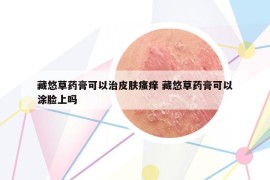 藏悠草藥膏可以治皮膚瘙癢 藏悠草藥膏可以涂臉上嗎