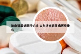 濟南銀屑病醫(yī)院論壇 山東濟南銀屑病醫(yī)院排名
