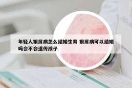年輕人銀屑病怎么結(jié)婚生育 銀屑病可以結(jié)婚嗎會(huì)不會(huì)遺傳孩子