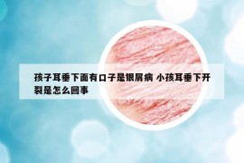 孩子耳垂下面有口子是銀屑病 小孩耳垂下開(kāi)裂是怎么回事