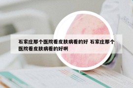 石家莊那個(gè)醫(yī)院看皮膚病看的好 石家莊那個(gè)醫(yī)院看皮膚病看的好啊