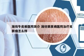 濰坊牛皮癬醫(yī)院簡介 濰坊銀屑病醫(yī)院治療皮膚病怎么樣