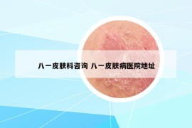 八一皮膚科咨詢 八一皮膚病醫(yī)院地址