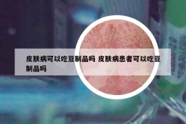 皮膚病可以吃豆制品嗎 皮膚病患者可以吃豆制品嗎