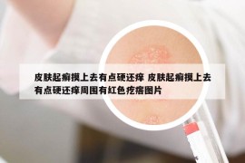 皮膚起癬摸上去有點(diǎn)硬還癢 皮膚起癬摸上去有點(diǎn)硬還癢周?chē)屑t色疙瘩圖片