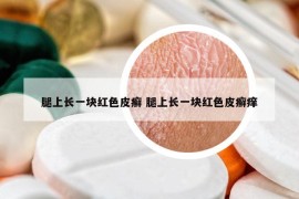 腿上長(zhǎng)一塊紅色皮癬 腿上長(zhǎng)一塊紅色皮癬癢