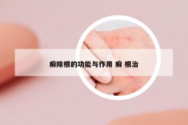 癬除根的功能與作用 癬 根治