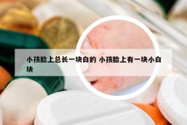 小孩臉上總長一塊白的 小孩臉上有一塊小白塊