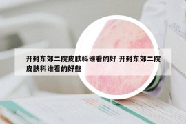 開(kāi)封東郊二院皮膚科誰(shuí)看的好 開(kāi)封東郊二院皮膚科誰(shuí)看的好些