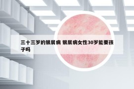 三十三歲的銀屑病 銀屑病女性30歲能要孩子嗎