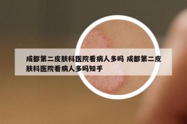 成都第二皮膚科醫(yī)院看病人多嗎 成都第二皮膚科醫(yī)院看病人多嗎知乎