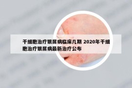 干細胞治療銀屑病臨床幾期 2020年干細胞治療銀屑病最新治療公布