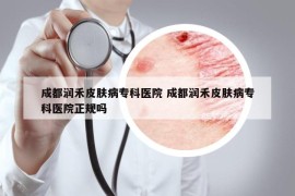 成都潤禾皮膚病?？漆t(yī)院 成都潤禾皮膚病?？漆t(yī)院正規(guī)嗎