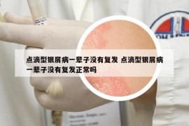點滴型銀屑病一輩子沒有復發(fā) 點滴型銀屑病一輩子沒有復發(fā)正常嗎