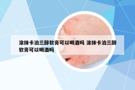 涂抹卡泊三醇軟膏可以喝酒嗎 涂抹卡泊三醇軟膏可以喝酒嗎