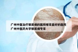 廣州中醫(yī)治療銀屑病的醫(yī)院哪家最好的醫(yī)院 廣州中醫(yī)藥大學(xué)銀屑病專家