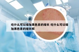 吃什么可以增加黑色素的增長 吃什么可以增加黑色素的增長呢
