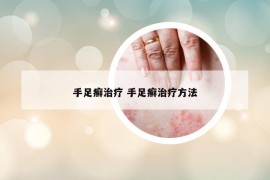 手足癬治療 手足癬治療方法
