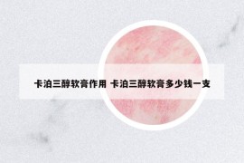 卡泊三醇軟膏作用 卡泊三醇軟膏多少錢(qián)一支