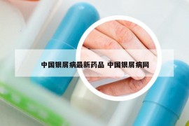 中國銀屑病最新藥品 中國銀屑病網(wǎng)