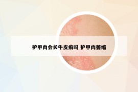 護甲肉會長牛皮癬嗎 護甲肉萎縮