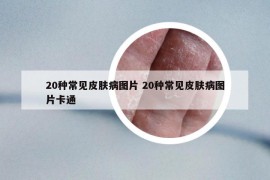 20種常見皮膚病圖片 20種常見皮膚病圖片卡通