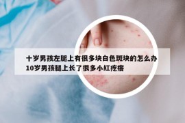 十歲男孩左腿上有很多塊白色斑塊的怎么辦 10歲男孩腿上長(zhǎng)了很多小紅疙瘩