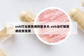 uvb燈治銀屑病劑量多大 uvb治療銀屑病皮膚變黑