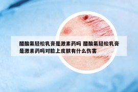 醋酸氟輕松乳膏是激素藥嗎 醋酸氟輕松乳膏是激素藥嗎對臉上皮膚有什么傷害