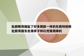 肚臍眼周圍起了好多跟蘚一樣的東西特別癢 肚臍周圍生出像疹子樣紅疙瘩很癢的