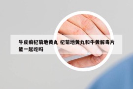 牛皮癬杞菊地黃丸 杞菊地黃丸和牛黃解毒片能一起吃嗎