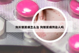 狗長(zhǎng)銀屑病怎么治 狗銀屑病傳染人嗎